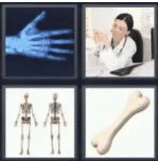 4 Pics 1 Word 4 Letter Answer bone